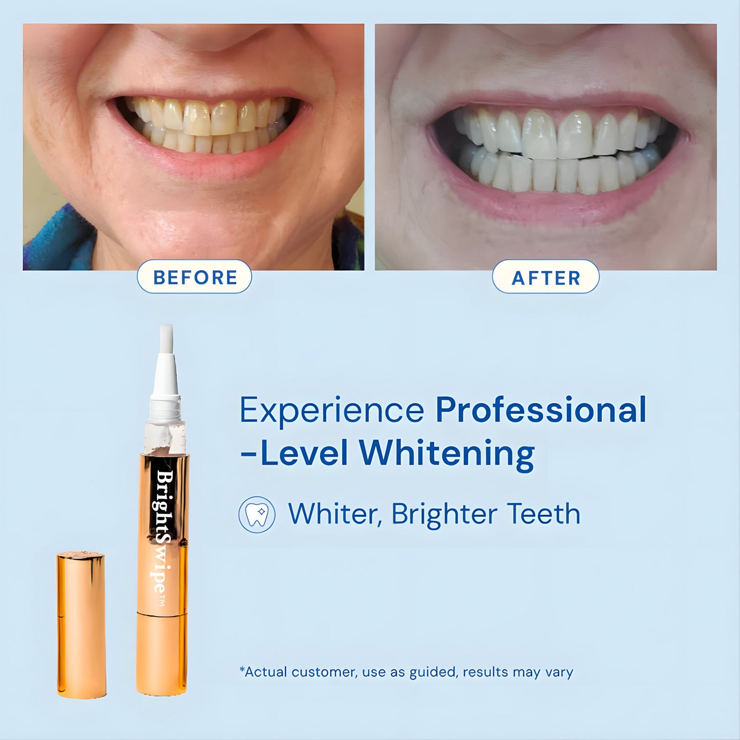 BrightSwipe™ Viral Teeth Whitening Serum Pen + Dual-Peroxide Formula & Xylitol