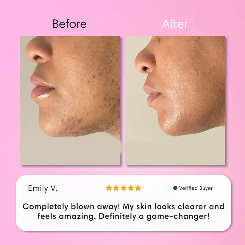 LumaBare - Hair Removal Cream