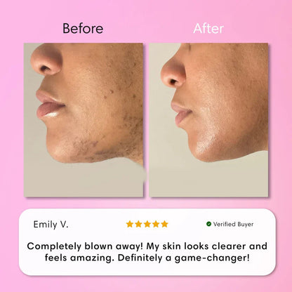 LumaBare - Hair Removal Cream