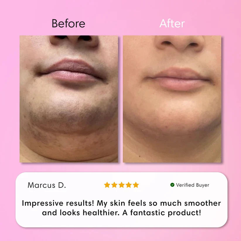 LumaBare - Hair Removal Cream