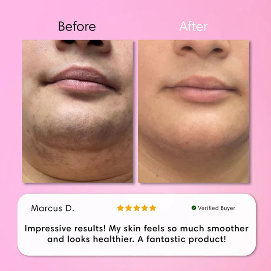 LumaBare - Hair Removal Cream