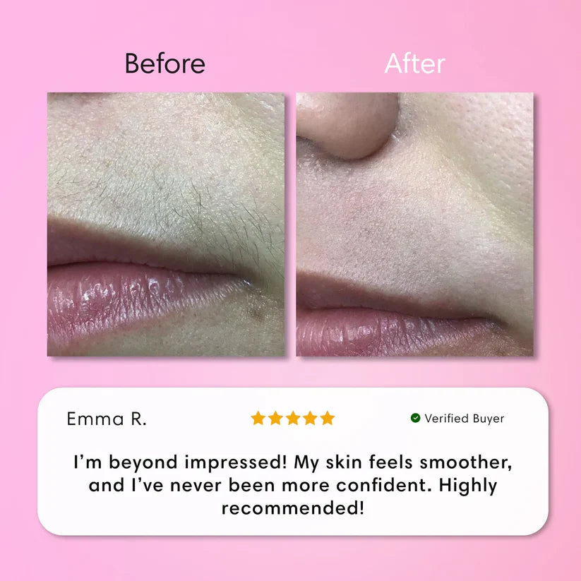 LumaBare - Hair Removal Cream