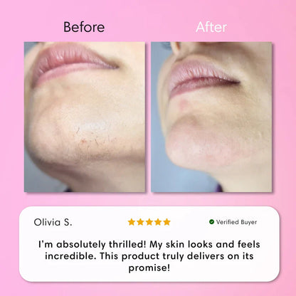 LumaBare - Hair Removal Cream