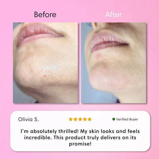 LumaBare - Hair Removal Cream