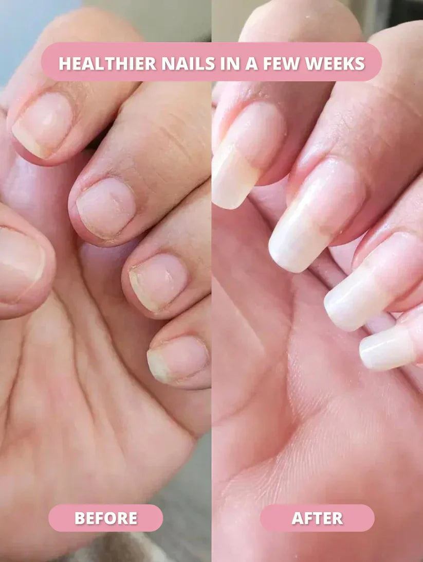 NaturaNail™ Growth Pen (75% OFF TODAY ONLY)