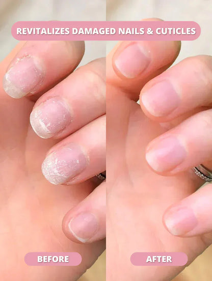 NaturaNail™ Growth Pen (75% OFF TODAY ONLY)