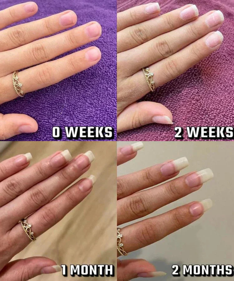 NaturaNail™ Growth Pen (75% OFF TODAY ONLY)